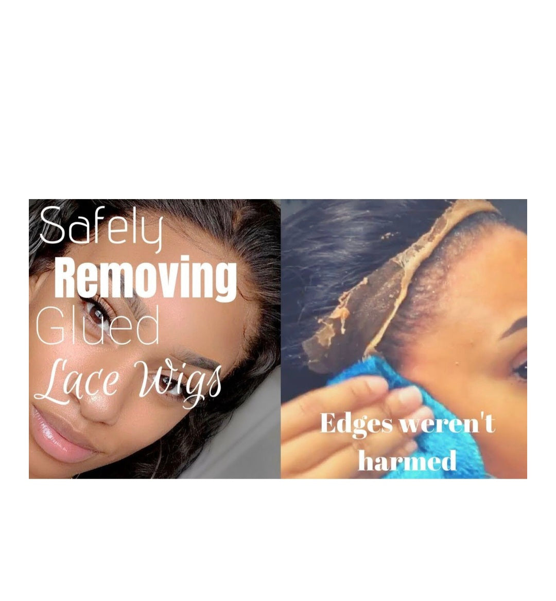 Lace Wig Glue Remover For Lace Wig Bond Toupee Tapes - Pack Of 2